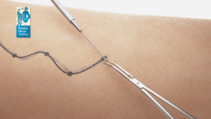 3D Animation | Riviera Veine Institut | Pharos Digital